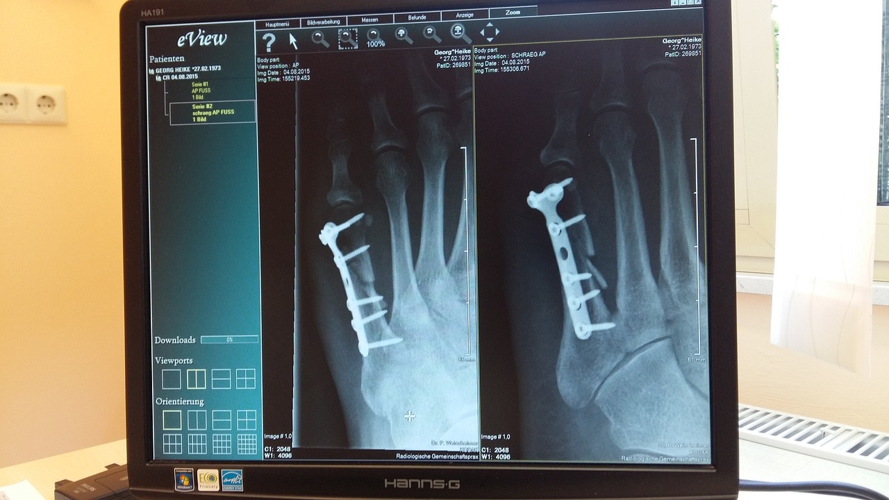 roentgen, x-ray image, clinic